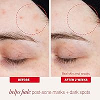 First Aid Beauty Lactic Acid Lotion 1oz — image 3