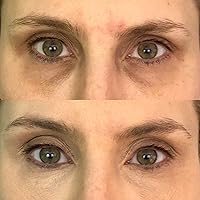 Dermaflage Color Correcting Palette, Medium — image 4