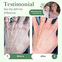 Theraplex Skin Barrier Balm 6oz — image 3