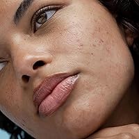 Obagi Rebalance Skin Barrier Recovery Cream 1.7oz — image 5