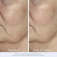 Obagi ELASTIderm Facial Serum – 1oz — image 5