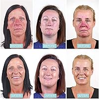 Rosalique 3 in 1 Anti-Redness Miracle Formula SPF50 30ml — image 3