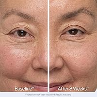 Obagi Nu-Cil Eyelash & Eyebrow Serum Set — image 5