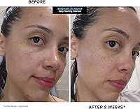 Kate Somerville EradiKate 3% Sulfur Daily Foaming Cleanser, 4 Fl Oz — image 7