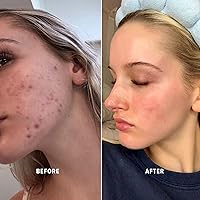 Bohemia Skin BOHO Skin Cleansing Balm 2oz — image 9