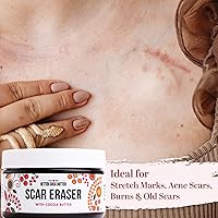 Better Shea Butter Scar Eraser Balm 4 oz — image 4