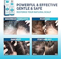 Roycederm Seborrheic Dermatitis & Psoriasis Cream, Shampoo and Conditioner Set — image 3