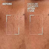 Dr. Brandt Pores No More Vacuum Cleaner - 1 oz — image 3