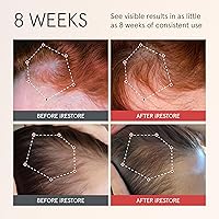 iRestore Scalp Serum 2 Fl Oz — image 2