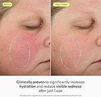 Skinfix Foaming Oil Cleanser 6 oz — image 3