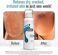 Footlogix DD Cream Mousse 4.23oz — image 3