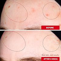 First Aid Beauty Lactic Acid Lotion 1oz — image 4