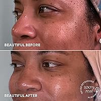 TULA Skin Care Bright Start Vitamin C Antioxidant Brightening Moisturizer 1.7oz — image 7