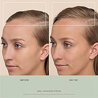 Vegamour GRO+ Advanced Hair Serum 1oz — image 8