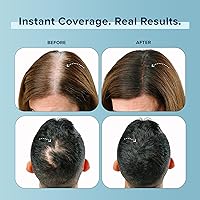 TRUHAIR Color Fibers Root Coverage Medium Brown — image 3
