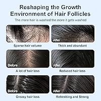 Tgideas Organic Biotin & Rosemary Hair Growth Shampoo – 16oz — image 6