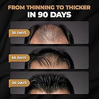 SPARTAN Root Activator Shampoo for Men 9.14oz — image 2