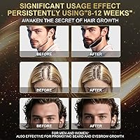 Sidinox 5% Minoxidil Foam with Biotin, 6 Month Supply — image 2