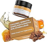 MyMagicHealer Universal Flare Care 1 oz — image 1