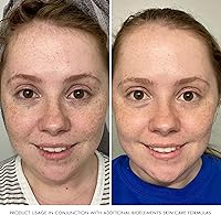 Bioelements Beyond Hydration Gel Facial Moisturizer 2.5oz — image 5