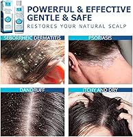 Roycederm Psoriasis Shampoo 7oz — image 5