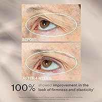 StriVectin Tighten & Lift Peptight Face Lift Serum — image 6