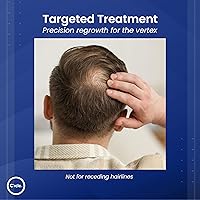 C’rcle Men’s Minoxidil 5% Foam 6-Month Supply — image 5