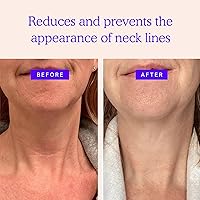 BLUMBODY Neck Wrinkle Patches – Anti-Wrinkle Silicone Patches (1-Month Supply) — image 2