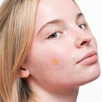 PEACE OUT Acne Healing Dots 60 Count — image 8