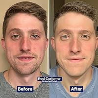 Strive Men's Face Moisturizer 1.7oz — image 2