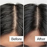 ACT+ ACRE Cold Processed Salicylic Acid Exfoliator 2 Fl Oz — image 5