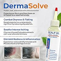 Dermasolve Psoriasis & Dandruff Oil 8oz — image 2