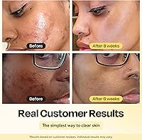 Gleamin Vitamin C Clay Mask 5.8oz — image 2