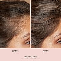 VEGAMOUR GRO Hair Serum 30mL — image 2