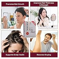 Vita Hair Growth & Hair Loss Supplement – 90 Capsules — image 2