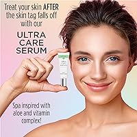Skin Clinic Ultimate Skin Tag Removal Kit — image 4