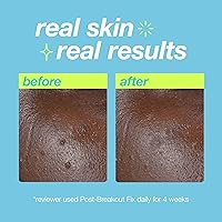 Dermalogica Clear Start Post-Breakout Fix — image 9