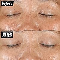 Kiehl's Clearly Corrective Dark Spot Serum 0.5oz — image 4