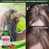 Botanical Hair Growth Treatment 4 Fl Oz — image 6