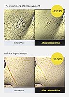 celimax The Vita A Retinol Shot Tightening Serum 30ml — image 4