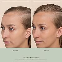 VEGAMOUR GRO+ Advanced Balancing Shampoo 8 Fl Oz — image 4