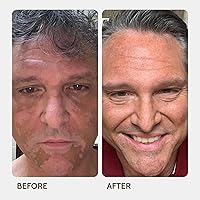 Fake Bake Vitiligo Vanquish Cosmetic Camouflage Kit — image 5