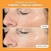 Paula's Choice BOOST C15 Super Booster 15% Vitamin C Serum, 0.67 Fl Oz — image 5