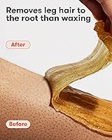 Sugardoh Sugar Waxing Kit Medium — image 7