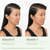 Divi Scalp Serum for Thinning Hair 8oz — image 5