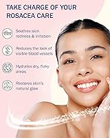 e70 Rosacea Treatment Skincare Set — image 4