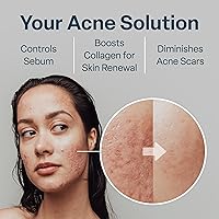 QRxLabs Salicylic & Glycolic Acid Pads 50 Count — image 4