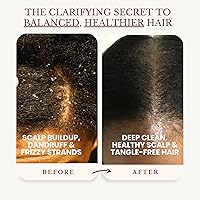 Edenika Botanicals Apple Cider Vinegar Shampoo & Conditioner Set, 16oz Each — image 3