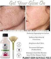 Planet Eden 80% GlyLactic Skin Chemical Peel — image 5
