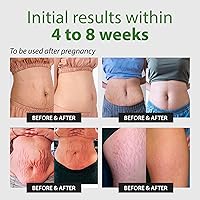 ABERA Maternity Stretch Mark Cream 4.16oz — image 4